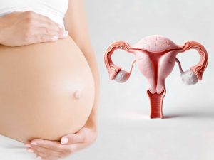 کیست مویی در بارداری - دکتر بتول طاهری