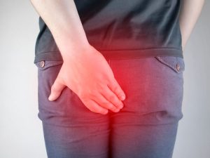 عمل جراحی کیست مویی یا سینوس پیلونیدال - دکتر بتول طاهری