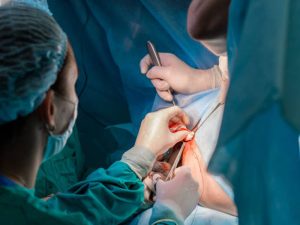 تنگی مقعد بعد از جراحی هموروئید - دکتر بتول طاهری