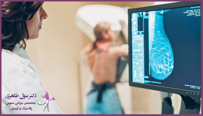 توده سینه همیشه نشانه سرطان است؟
